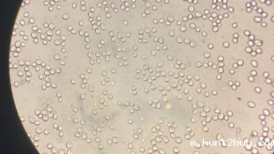 水解啤酒废酵母生产蛋白饲料的酶制剂有哪些？